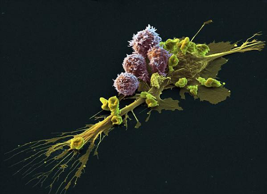 免疫細(xì)胞 免疫細(xì)胞存儲(chǔ)