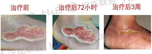 漢氏聯(lián)合