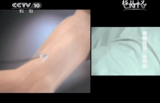 漢氏聯(lián)合可以儲(chǔ)存免疫細(xì)胞嗎 漢氏聯(lián)合可以儲(chǔ)存免疫細(xì)胞嗎